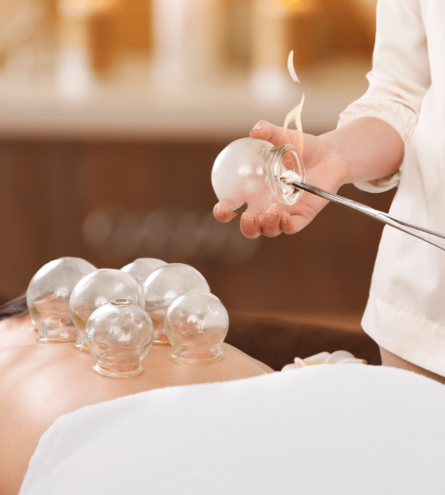Fire cupping therapy